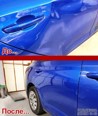 Удаление вмятины двери без покраски Hyundai Accent PDR фото